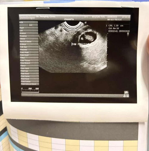 8weekน้องประมาณกี่เซนกันคะ