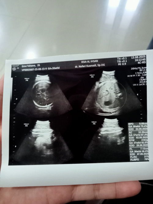 Hamil 36 week, bbj 3162 gram