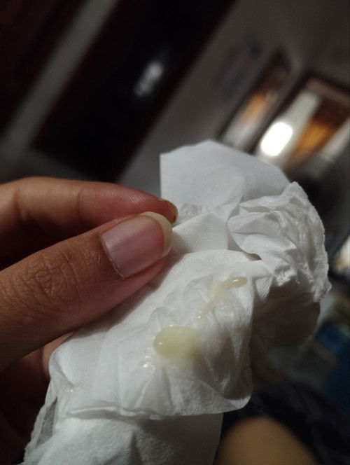 Ini keputihan/lendir tanda persalinan ya bund?