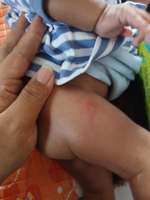 Apa dan gimana cara ngatasinnya