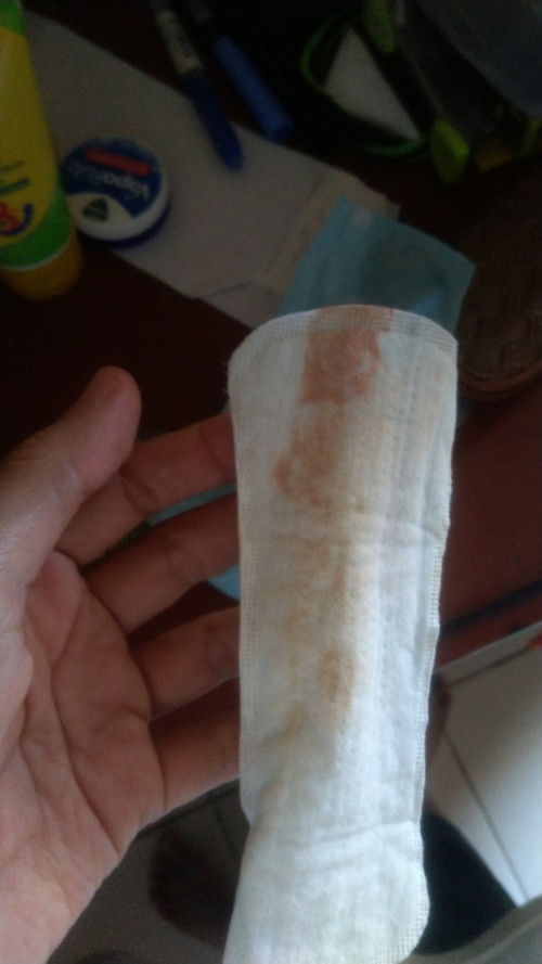 Nifas atau haid?