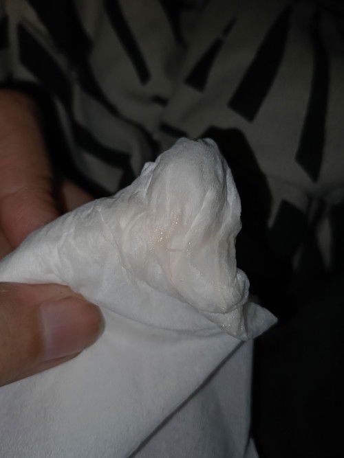 Bumil 13minggu kdng keputihan gatal