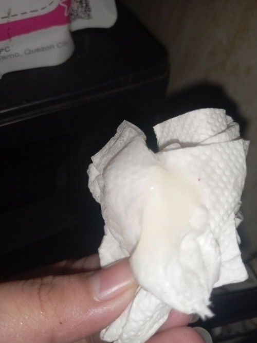 ask lang po normal lang po ba ito may lumabas po saakin na ganito