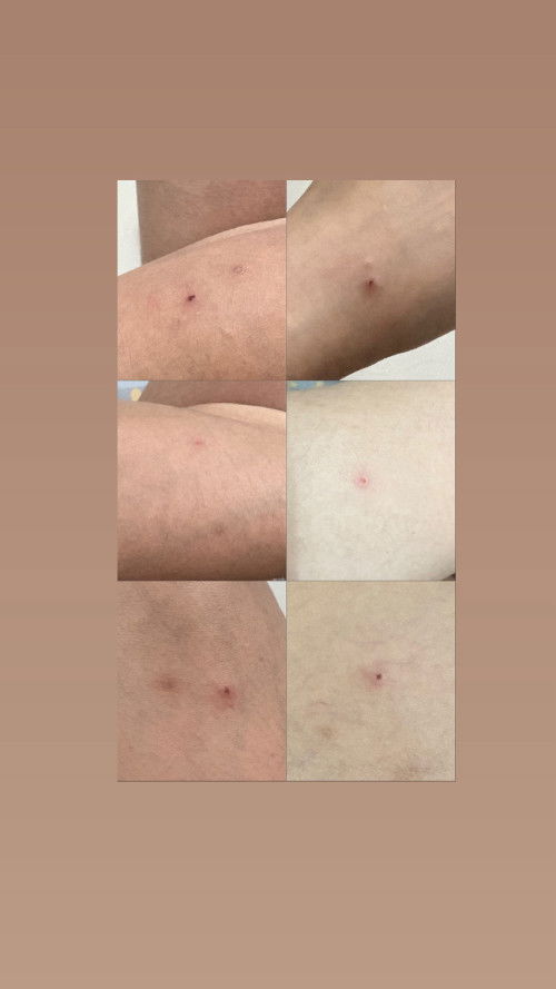 Gatal gatal sejak hamil