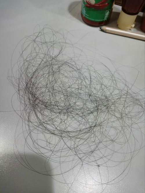 HAMIL RAMBUT RONTOK PARAH