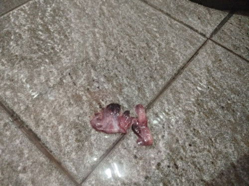 Haid kedua setelah. Melahirkan