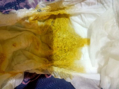 Bertanya masalah fases