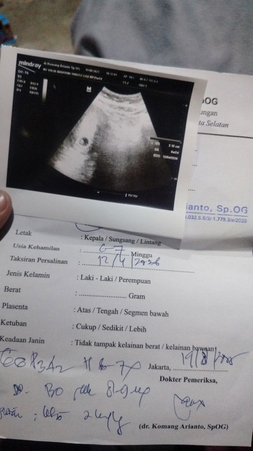 Saya mau tanya hpht sy di pertengahan Juni kmren USG harus nya 9minggu ini baru 6 apa ini normal