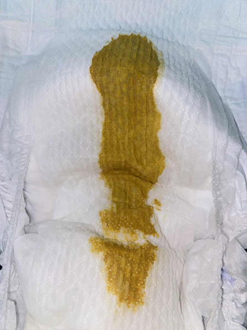 Popok bayi