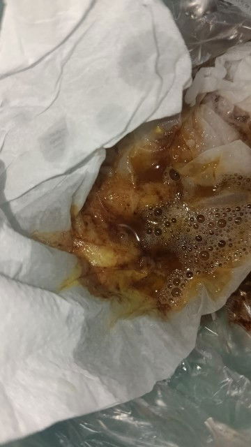 Malam bun, maaf kalo liat jijik aku di usia  9 minggu sering ngalamain muntah kaya gini normal gx ya