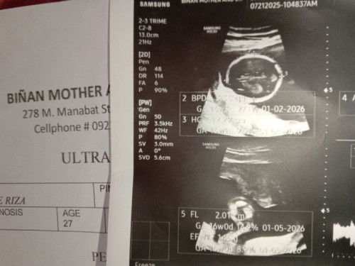 About gender sana baby boy na