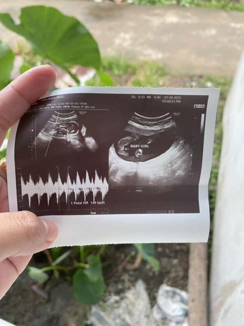 Boy or Girl