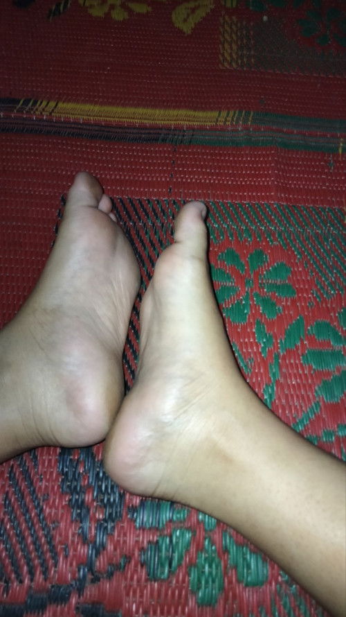 Telapak kaki sakit terasa bengkak