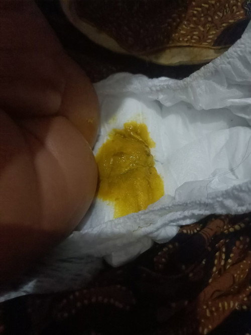 Mom, kmrn abis suntik dpt 2 ko pup nya malah ky mencret ya udh 5x. Ada yg sama ga kira2???