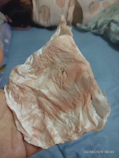 Keluar darah 13minggu 5 hari normal x