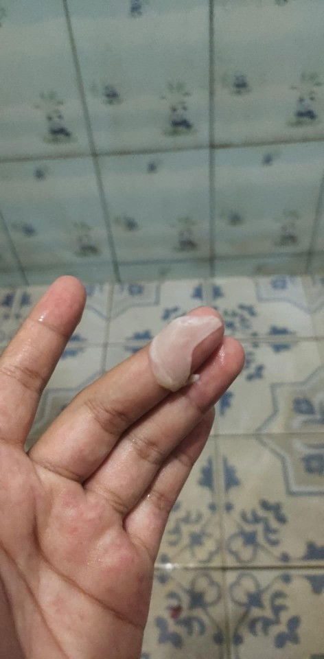 36+4แบบนี้คือมูกหรือตกขาวเฉยๆคะมันดึ้ยๆเหมือนเจลลี่