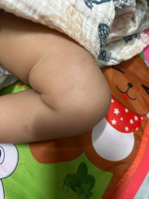 TOLONG KITA MOMMY. KESIAN ANAK 😭