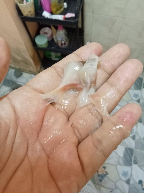 39+3เป็นแบบนี้ต้องไปหาหมอมั้ย