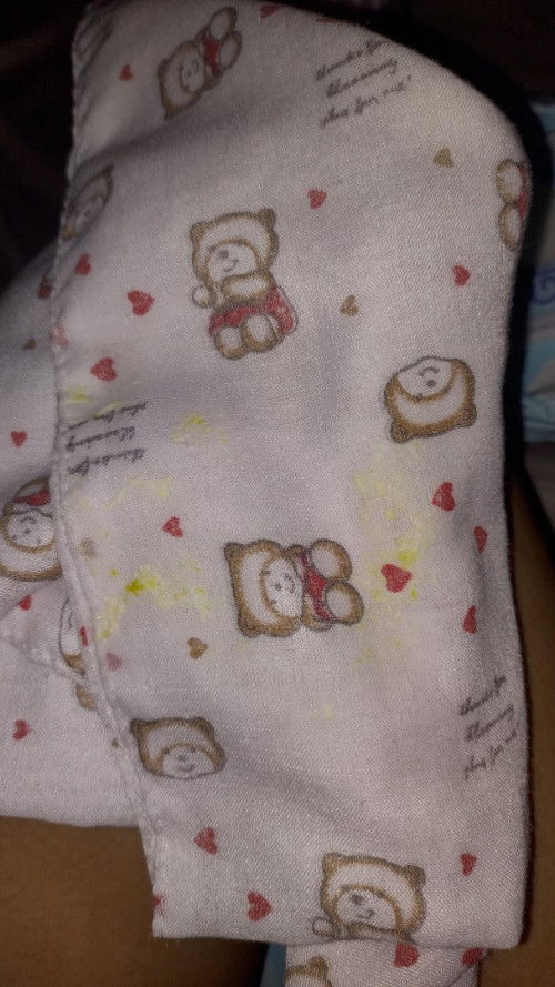 ลูกแหวะนมเป็นสีเหลืองๆ ออกมา