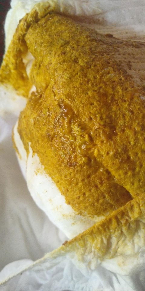 ใช่ถ่ายปนมูกมั้ย