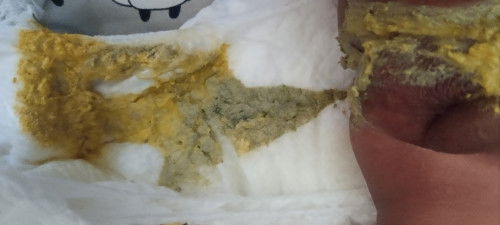 Pup bayi 4 bln 2 hari