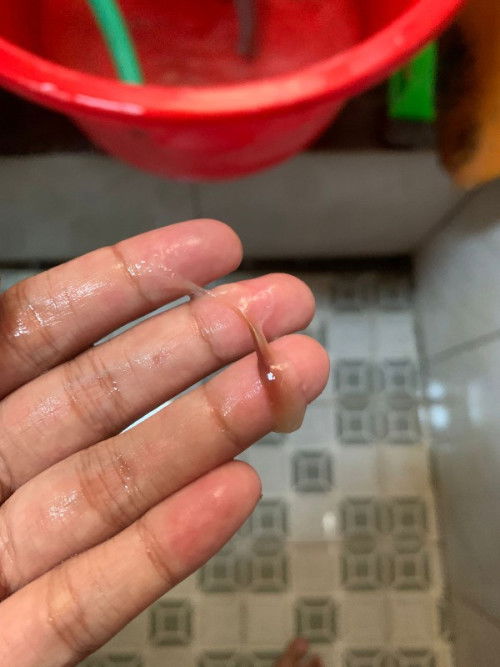 maaf bunda mau tanya kehamilan 36 minggu keluar lendir spt ini knp ya. apa mungkin mau persalinan.