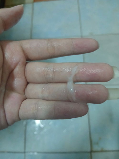 มูกใสแบบนี้ปกติมั้ยคะแม่ๆ