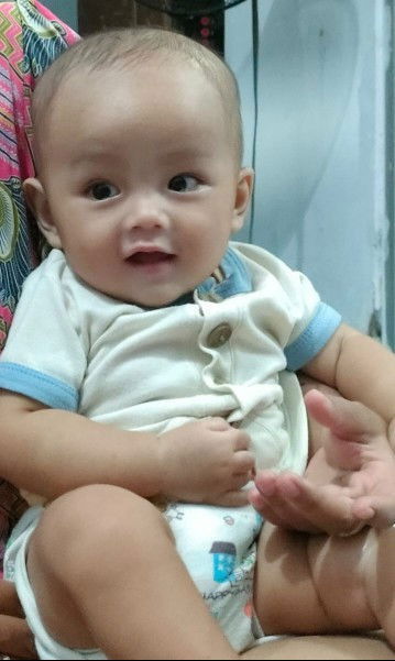 Telinga kanan dan kiri ukurannya berbeda