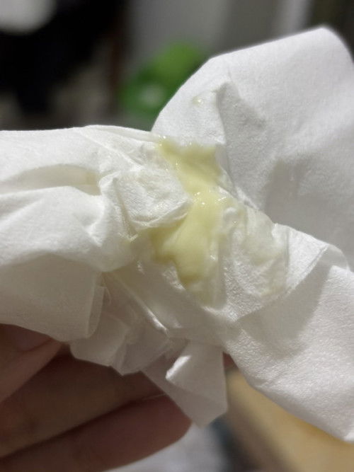 keputihan di kehamilan 6 minggu