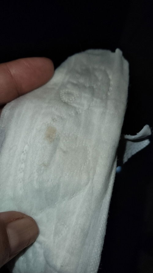Bunda² mau tanya apakah ini flek atau apa, sudah 4hari perut mules hilang timbul. Usia 33 week