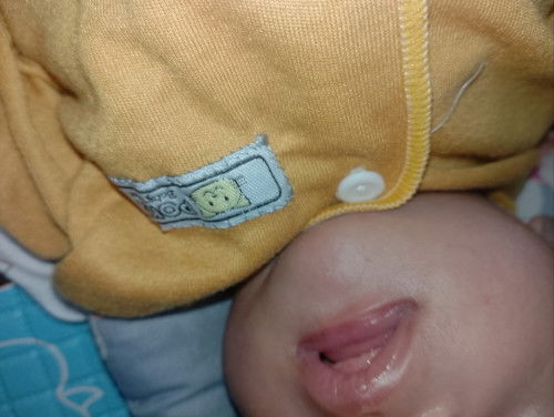 masalah bibir bayi