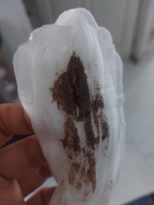 Lagi bingung karena hamil dan keluar darah terus