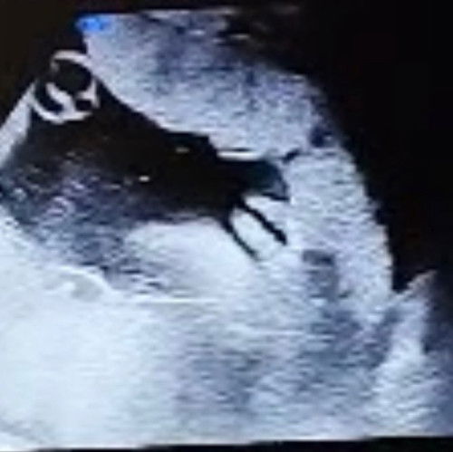 Confirm ke baby girl?