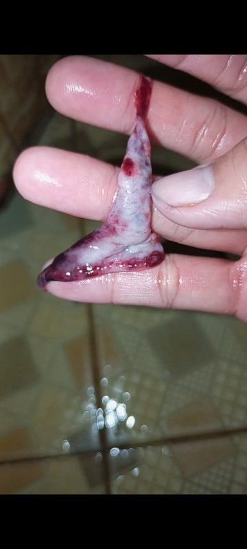 saat haid keluar gumpalan putih