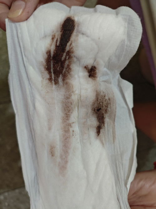 Implantation bleeding?