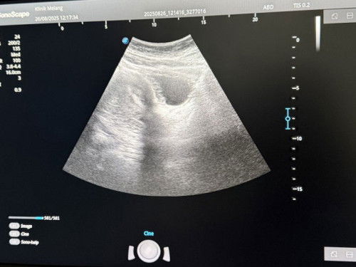 Patut ke makan ubat turun darah?