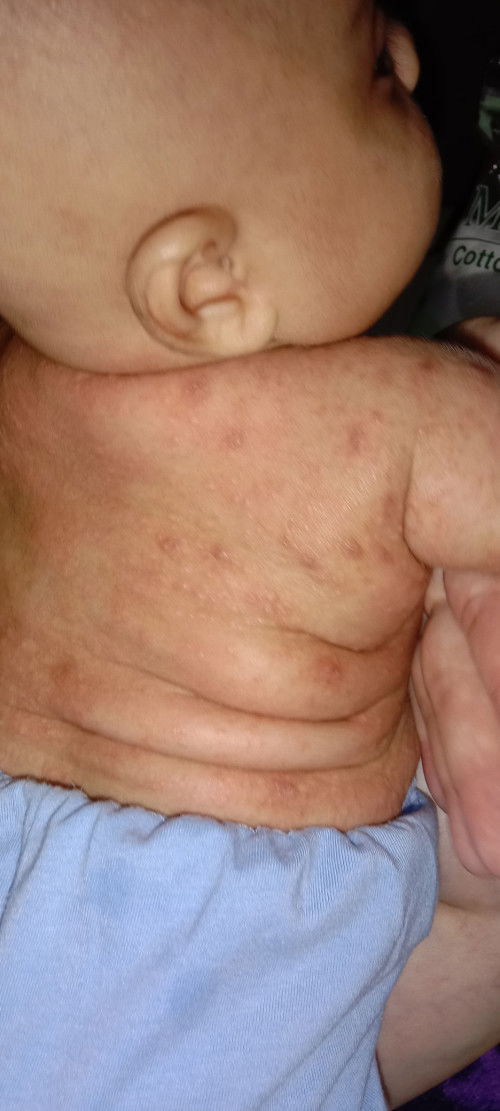 Kulit bayi 2 bulan