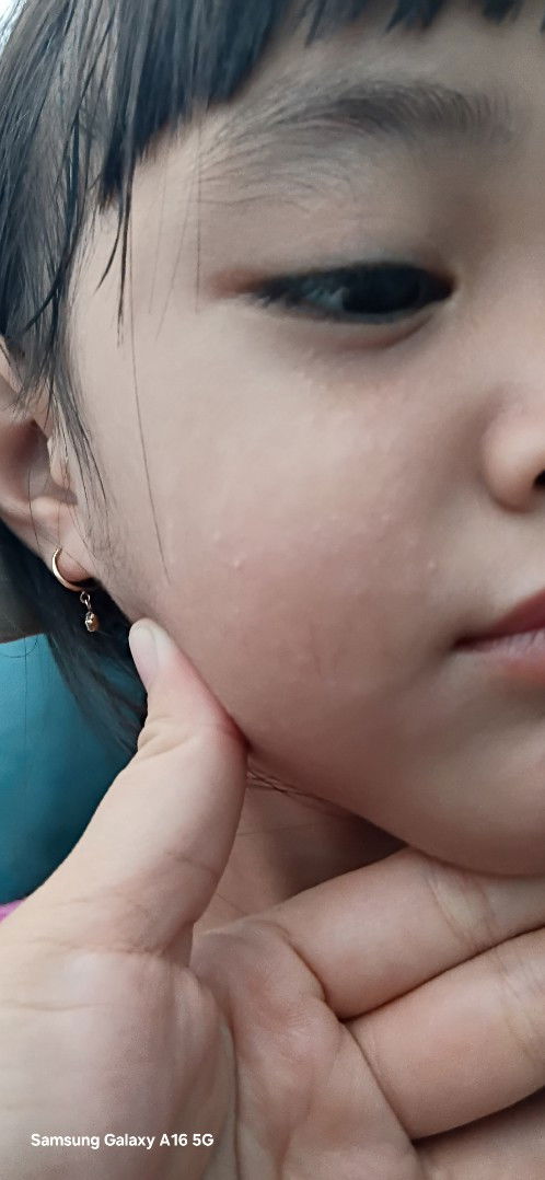 Ada yang tau gak disini . Ini knpa ya kira2 udah berobat 3 kali gak sembuh2,