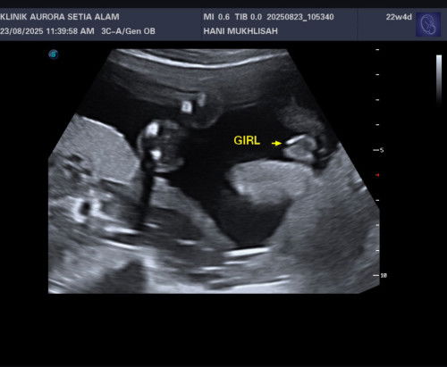 Girl or Boy