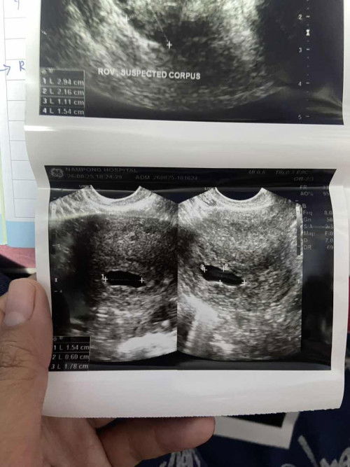 7+2wยังไม่เจอน้องเลยค่ะแม่ๆเจอน้องกันกี่Wบ้างคะ