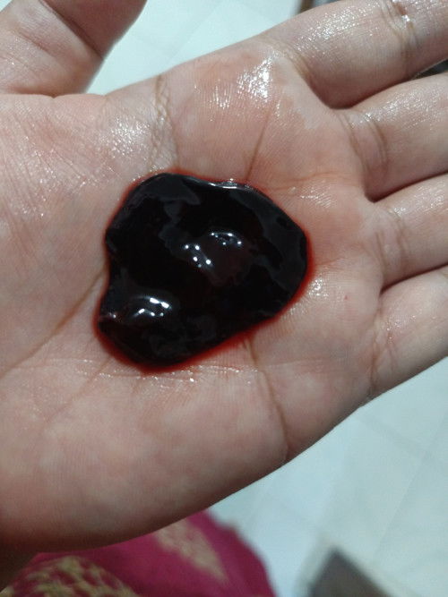 Apakah tanda keguguran