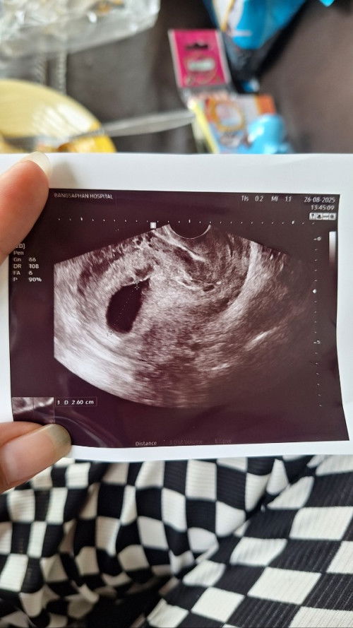 12w5d ช่วยดูหน่อยค่ะ