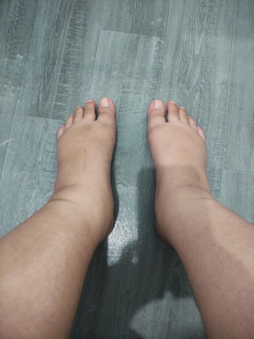 Kaki bengkak di usia kandungan 40 minggu