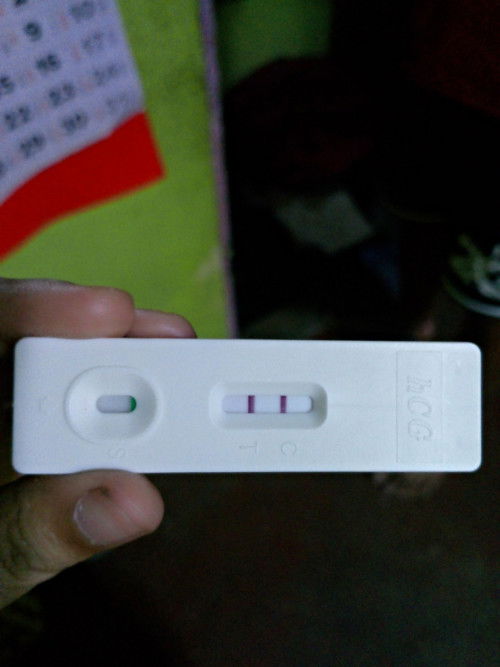 Mga mi, ano po ba ibig sabihin ng anterior placenta no previa?