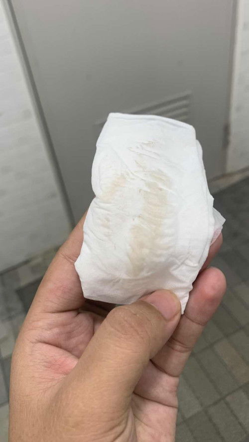 แบบนี้ใกล้คลอดยังคะ38+2