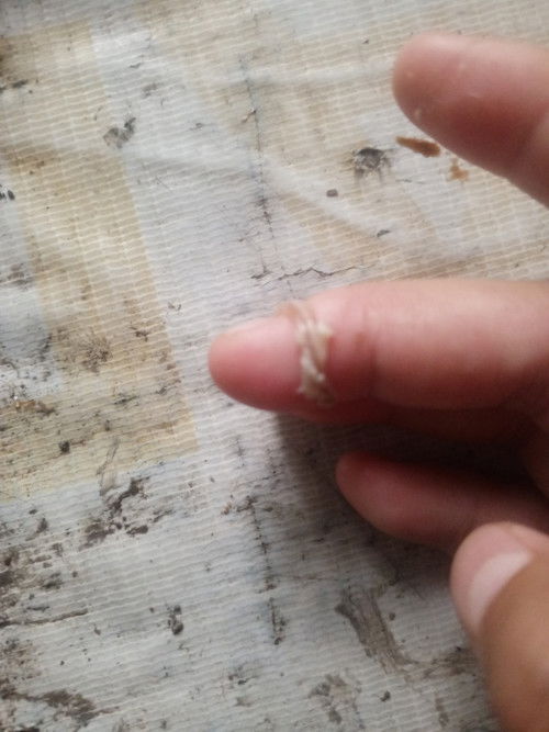Mucus plug po ba Yan mga mie o white blood lang