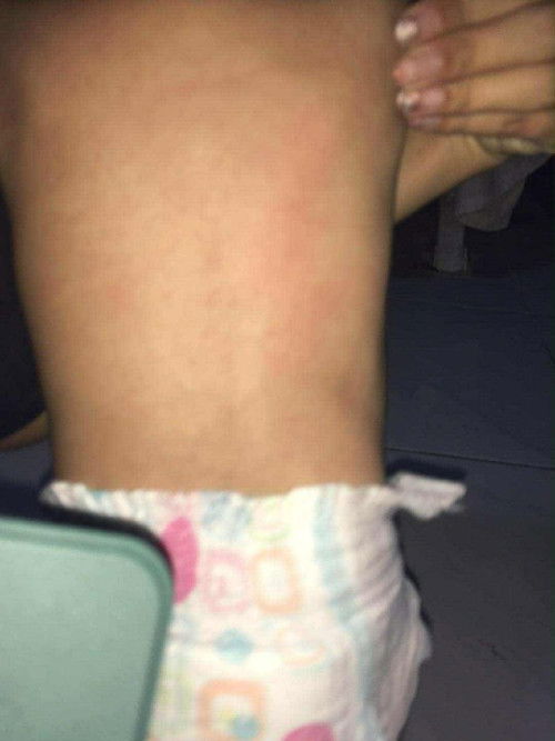 แม่ๆค่ะน้องเป็นอะไร?