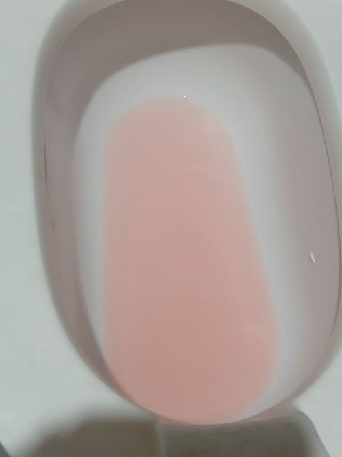 Reddish pink urine.