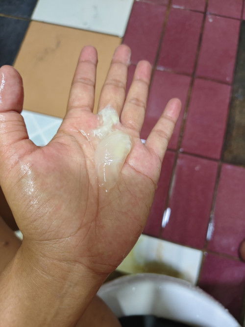 มีมูกใสๆออกมาแบบนี้ควรไปรพ.ไหมคะ ไม่มีอาการปวดท้อง แต่เวลาเดินรู้สึกหน่วงๆท้อง