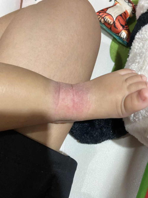 อยากทราบว่าน้องเป็นอะไรค่ะ